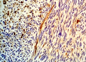 GIST image